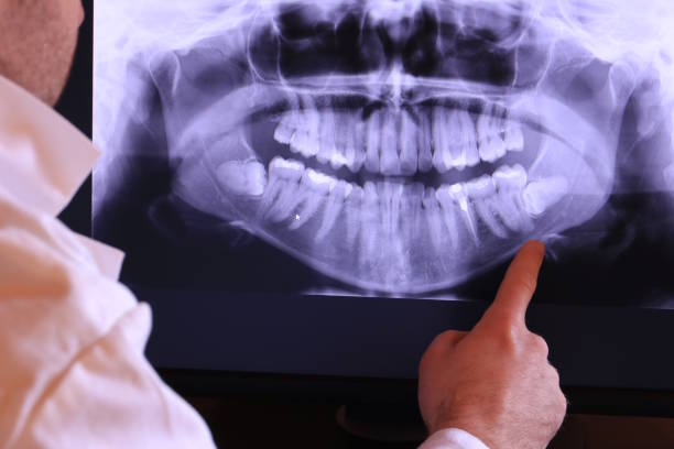 Best Pediatric Emergency Dentist in Wildwood, TN