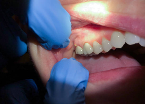 Best After-Hours Emergency Dentist in Wildwood, TN