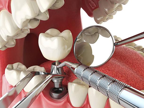 Best Emergency Orthodontic Repairs in Wildwood, TN